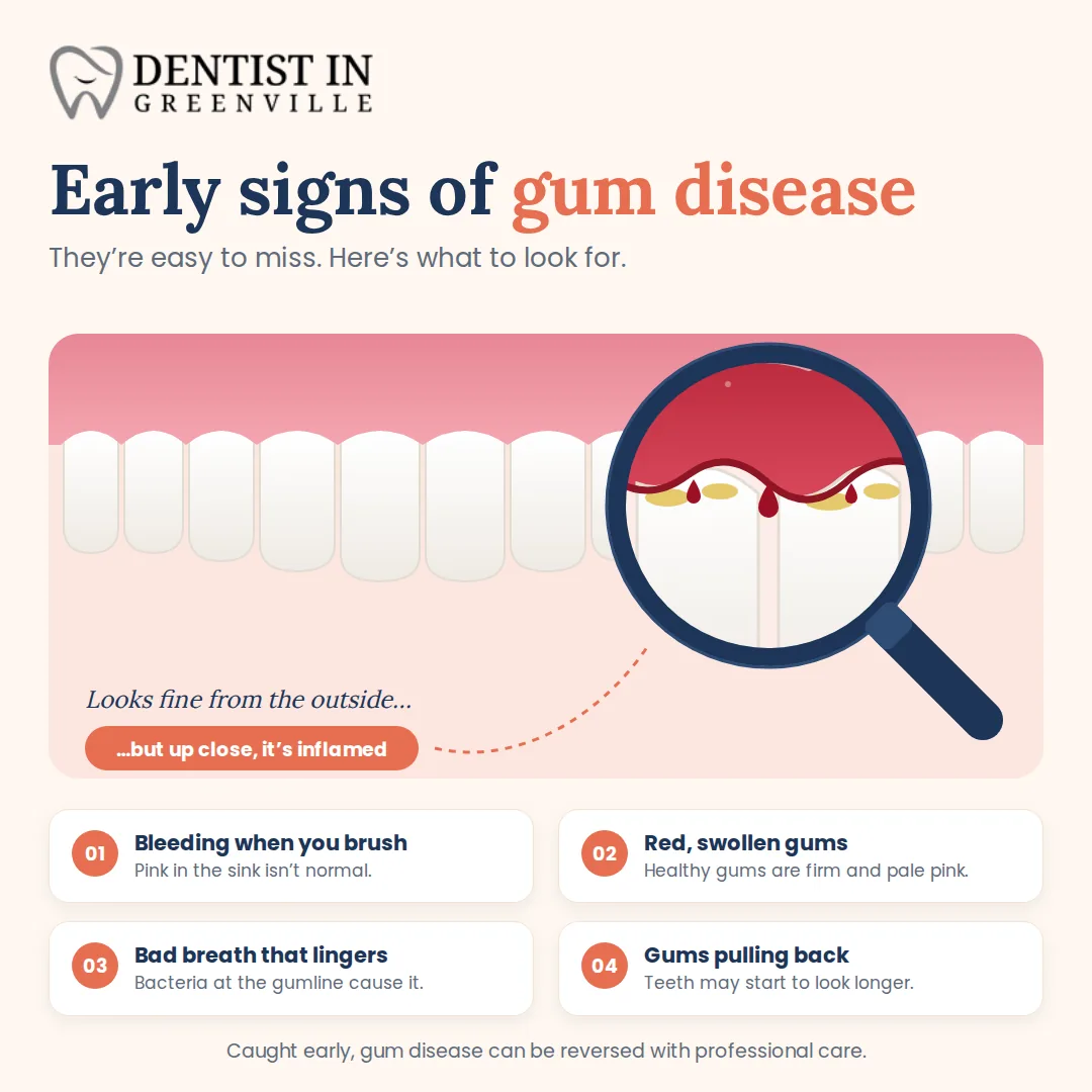 Early Signs of Gum Disease You Shouldn't Ignore